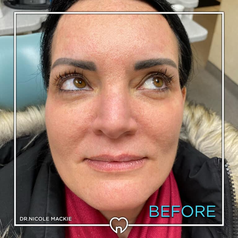 Dr. Mackie Smile Gallery