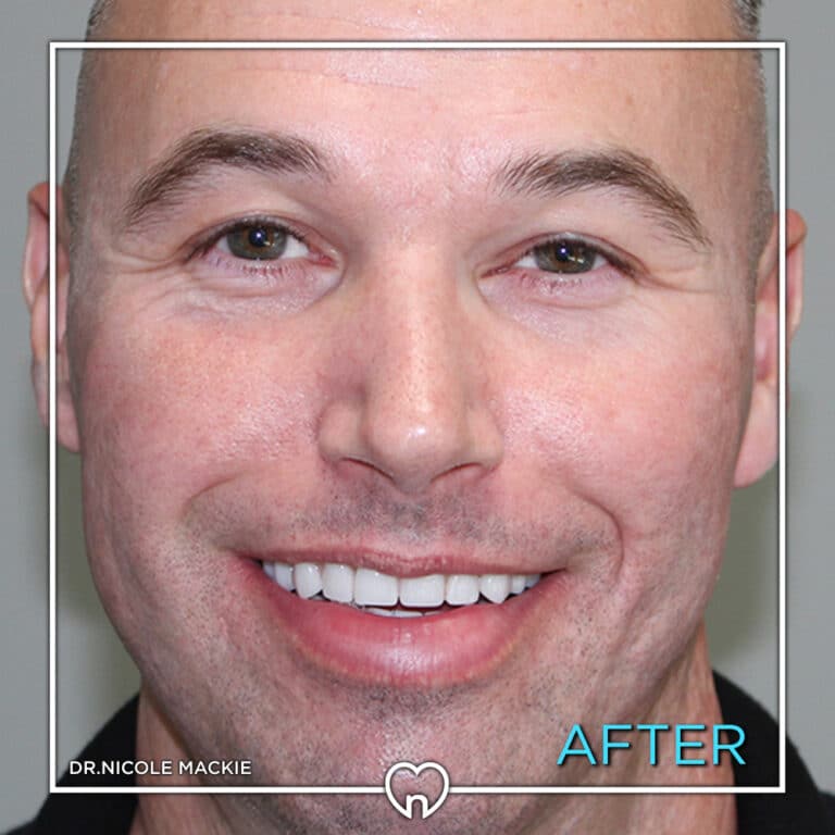 Dr. Mackie Smile Gallery