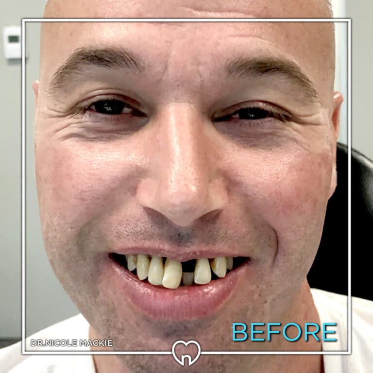 Dr. Mackie Smile Gallery