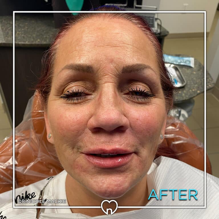 Dr. Mackie Smile Gallery