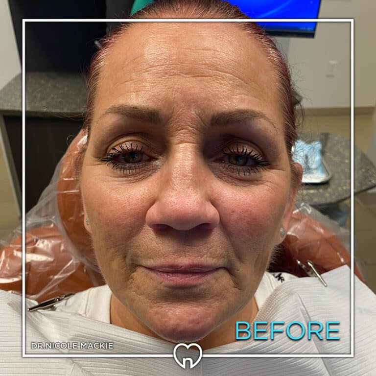 Dr. Mackie Smile Gallery