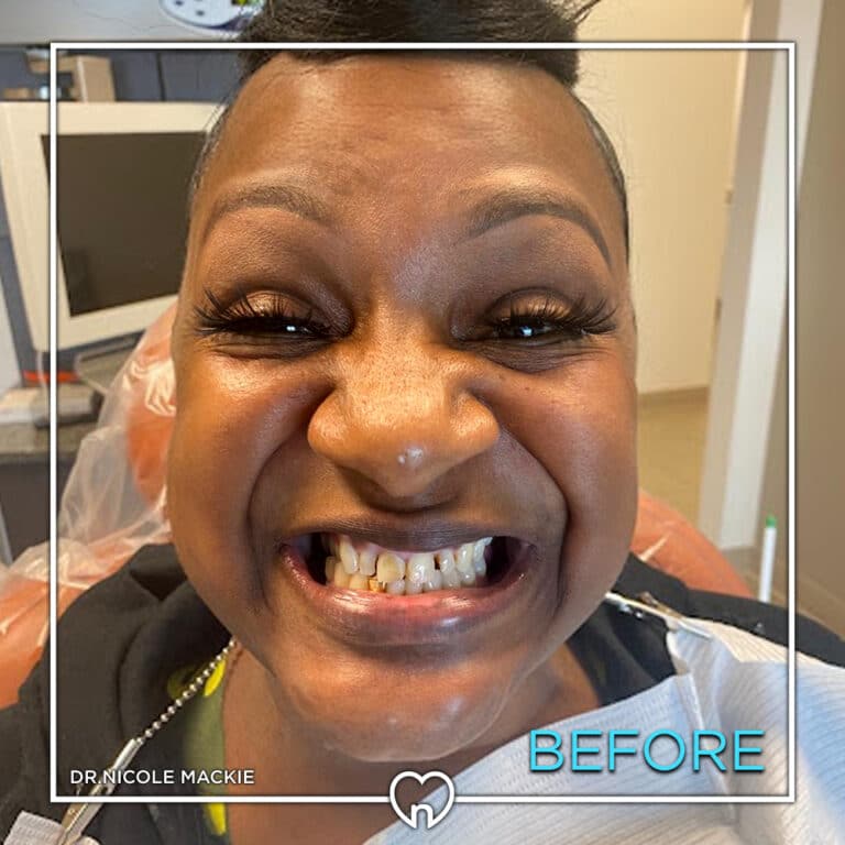 Dr. Mackie Smile Gallery