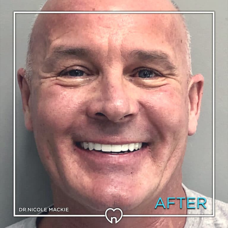 Dr. Mackie Smile Gallery