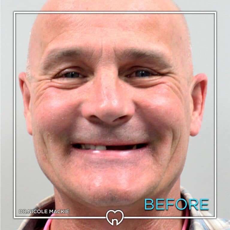 Dr. Mackie Smile Gallery