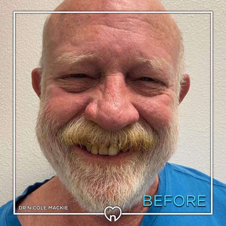 Dr. Mackie Smile Gallery