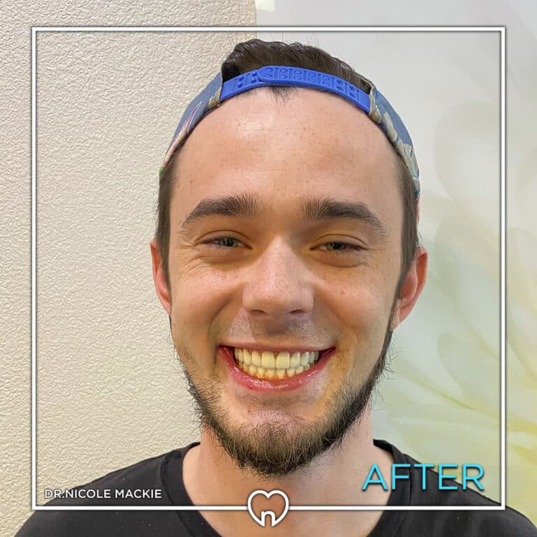 Dr. Mackie Smile Gallery