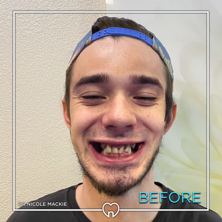 Dr. Mackie Smile Gallery