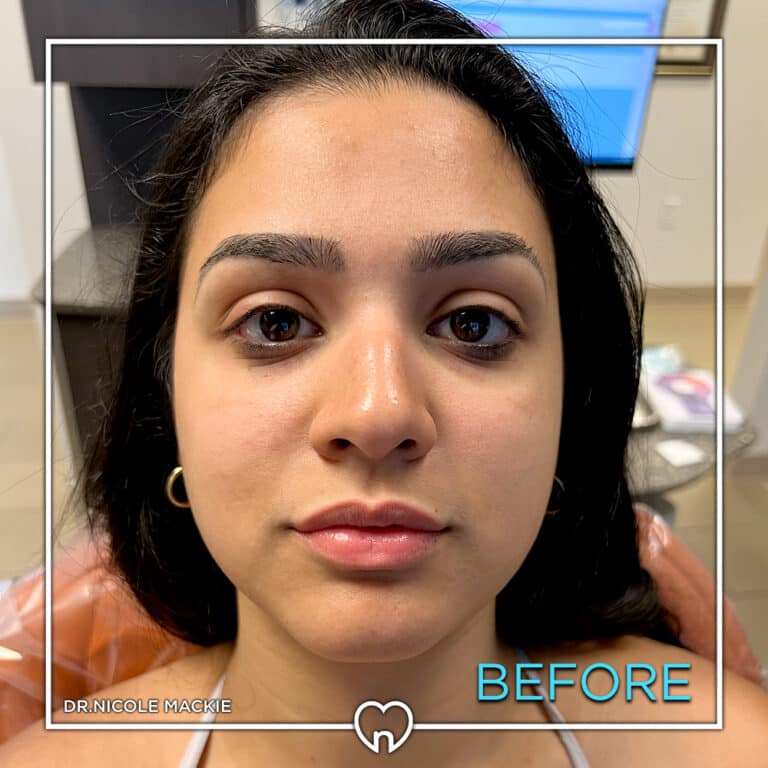 Dr. Mackie Smile Gallery