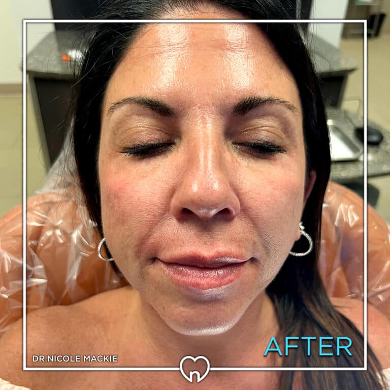 Dr. Mackie Smile Gallery