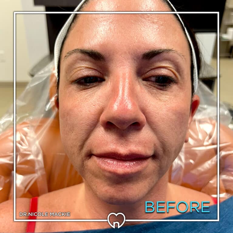 Dr. Mackie Smile Gallery