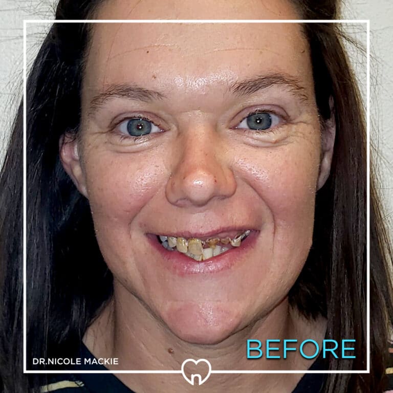 Dr. Mackie Smile Gallery