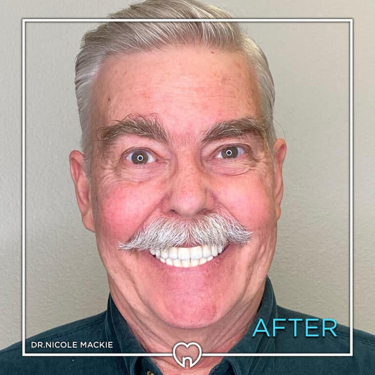 Dr. Mackie Smile Gallery