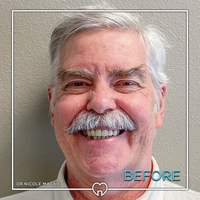 Dr. Mackie Smile Gallery