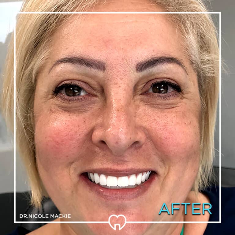 Dr. Mackie Smile Gallery