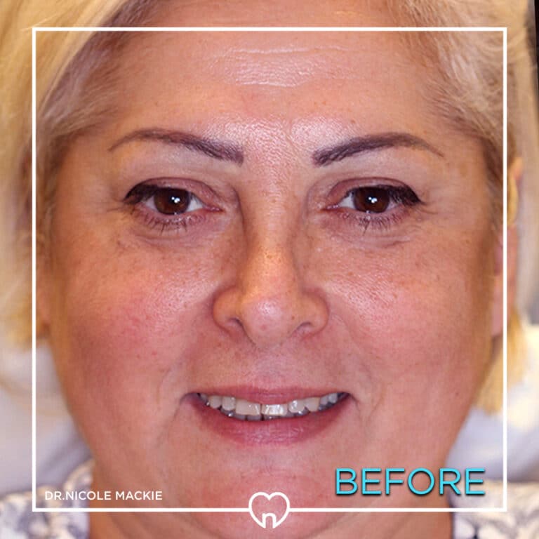 Dr. Mackie Smile Gallery