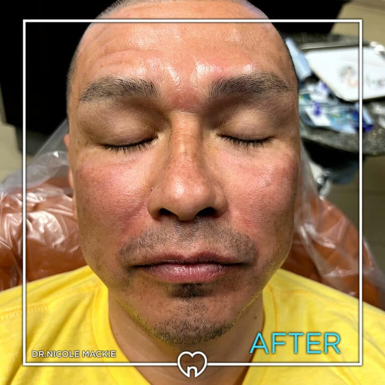 Dr. Mackie Smile Gallery