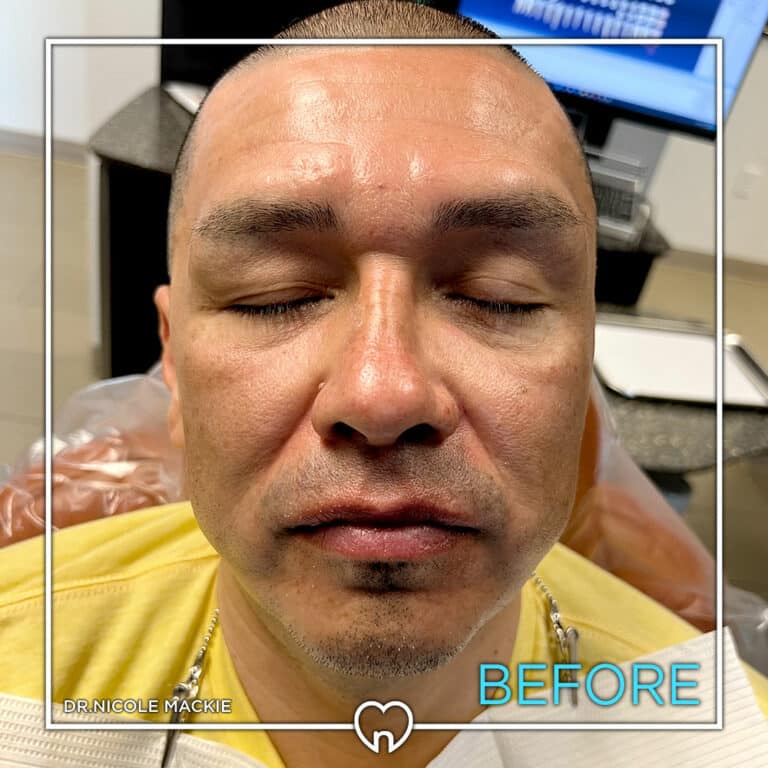 Dr. Mackie Smile Gallery