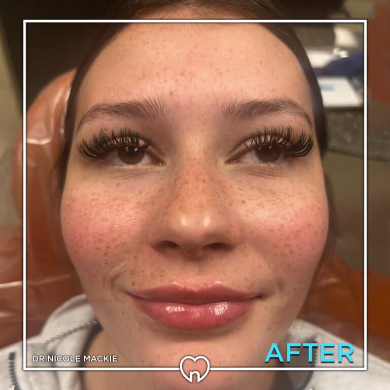 Dr. Mackie Smile Gallery