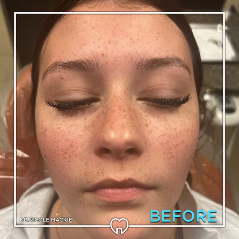 Dr. Mackie Smile Gallery