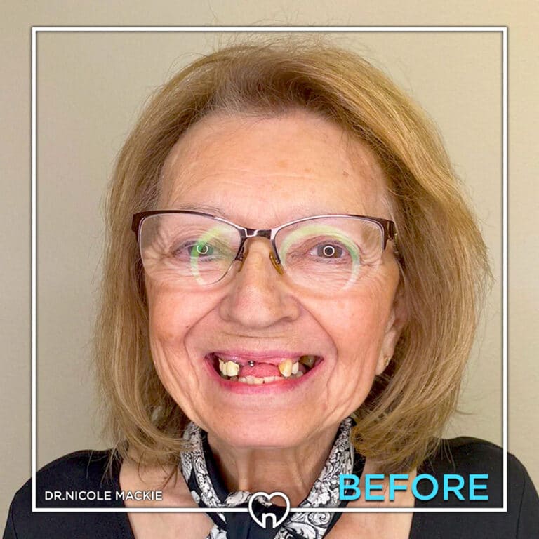 Dr. Mackie Smile Gallery