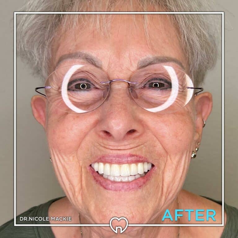 Dr. Mackie Smile Gallery