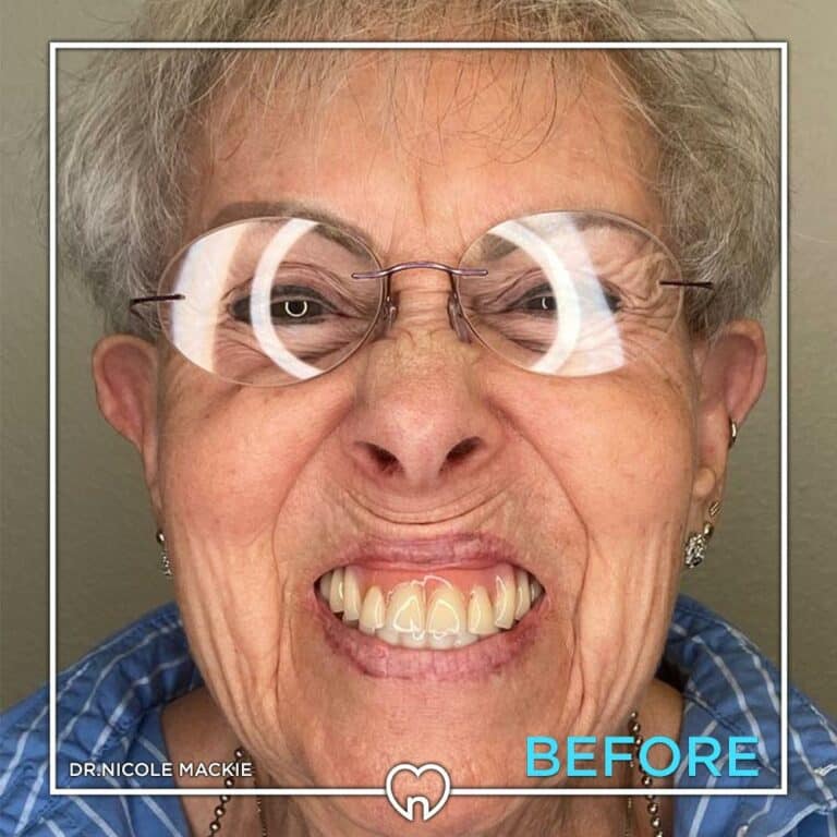 Dr. Mackie Smile Gallery