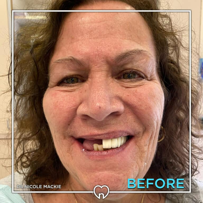 Dr. Mackie Smile Gallery