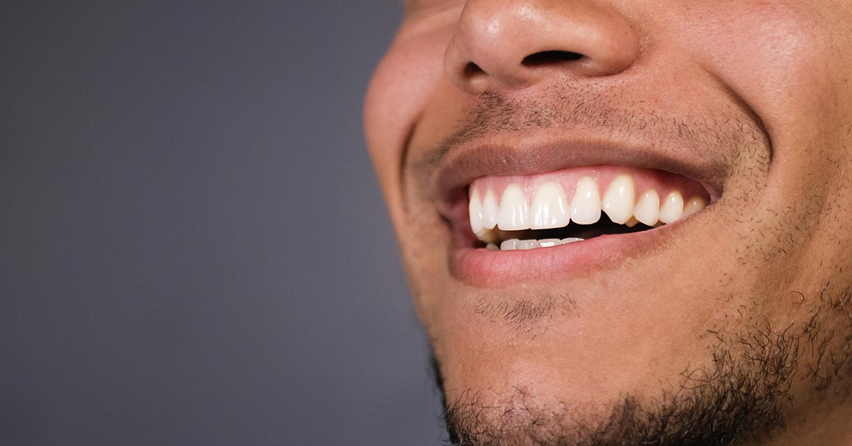 Fix gummy smile Las Vegas