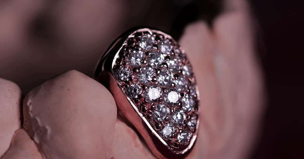 Kanye West Teeth Grills