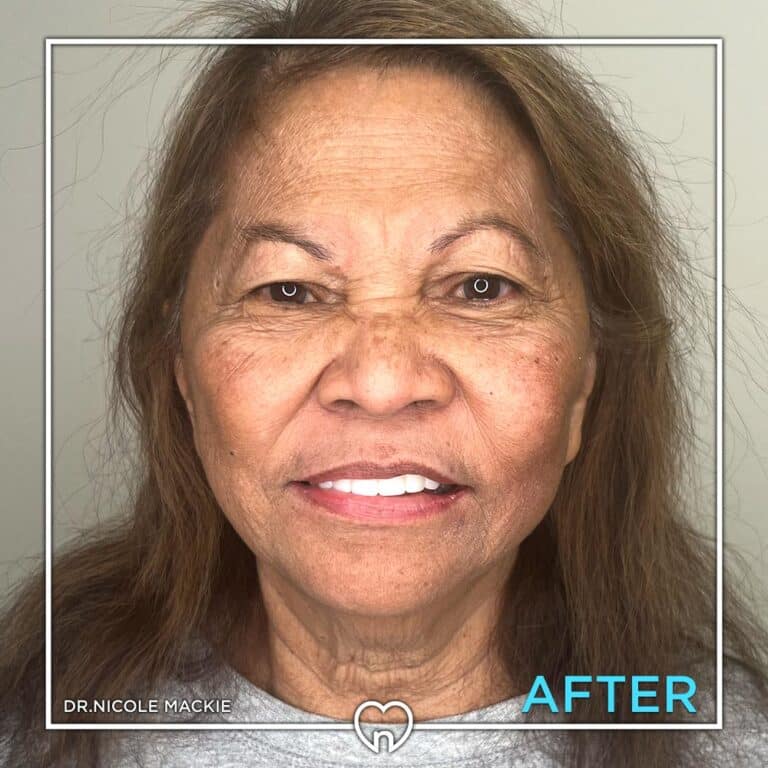 Dr. Mackie Smile Gallery