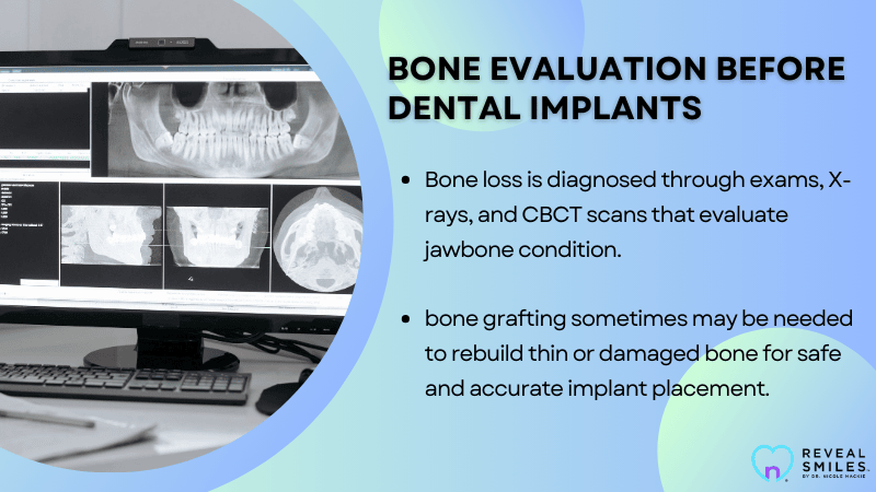 Assessing the Need for Bone Grafting Before Implant Placement