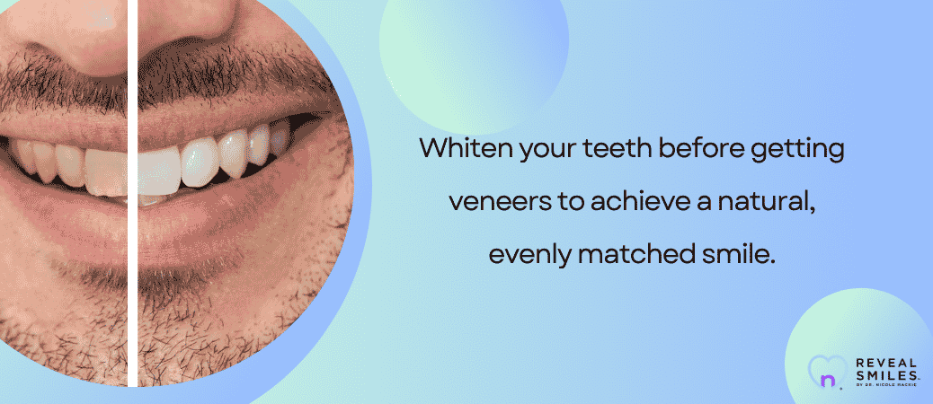 Preventing a Two Tone Smile