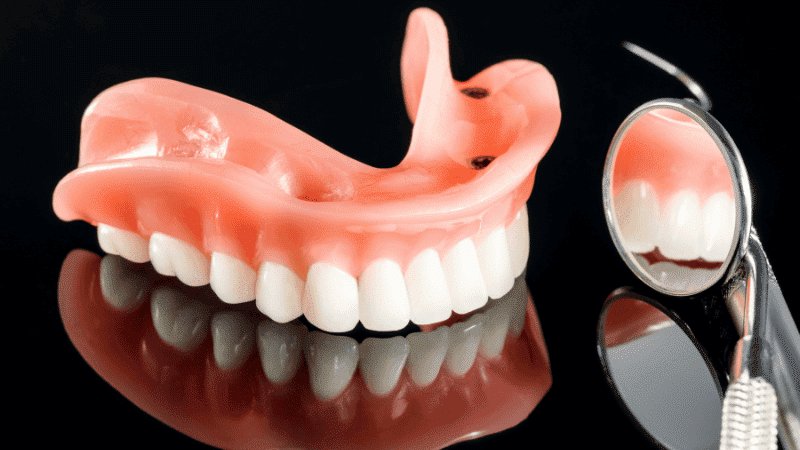 all on 4 vs traditional implants