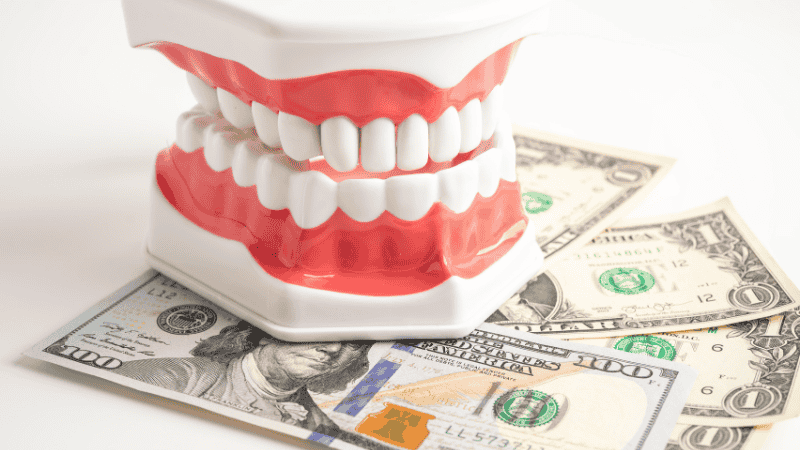 dental implant cost factors